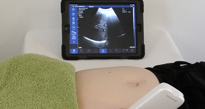 Ultrasound of the Diaphragm for Breathing Pattern Disorders