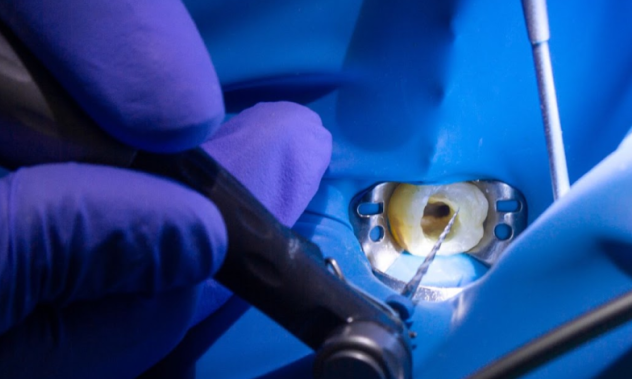 Rotary Endodontic Course