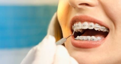 Periodontic and Orthodontic Interface 2023